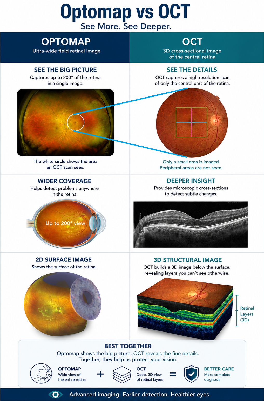 Optomap vs OCT 2nd iteration edit Optomap vs OCT retinal imaging in Ajax