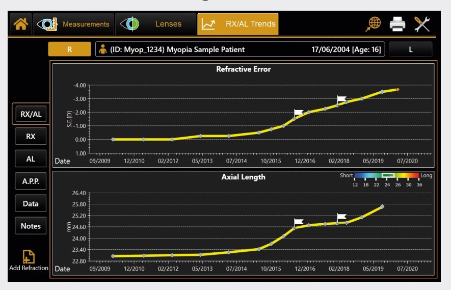 Myopia Control - Axial Length Measurement tracking