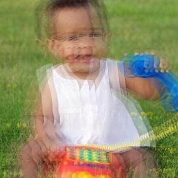 Double Vision Diplopia Concussion Ajax Ontario